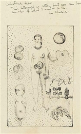 Frida Kahlo, FRIDA AND THE MISCARRIAGE
