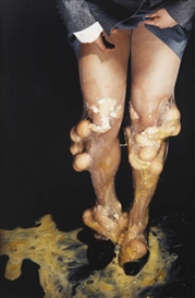 Patty Chang, Legs (TKO)