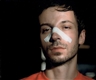 Phil Collins, Sinisan (broken nose)