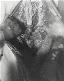 Hermann Nitsch, Aktion (31st Campaign/Mission)