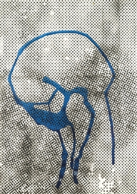 Sigmar Polke, UNTITLED