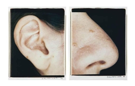 John Baldessari, Ear and Nose: Right Side (Analia)