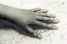 Peter Peryer, Thea's Hand