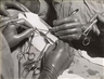 Hansel Mieth, Group of 7 intimite photographs of surgery being performed on an unidentified body part