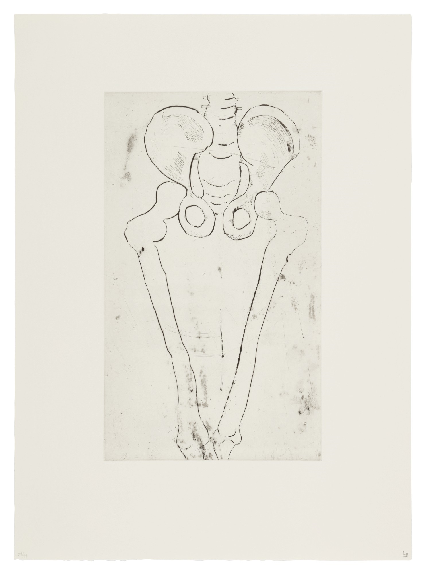 Self Portrait by Louise Bourgeois, 1990, Drypoint, etching, and