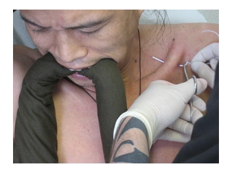 "Dragon Fish" 2006 - Hu Yunchang