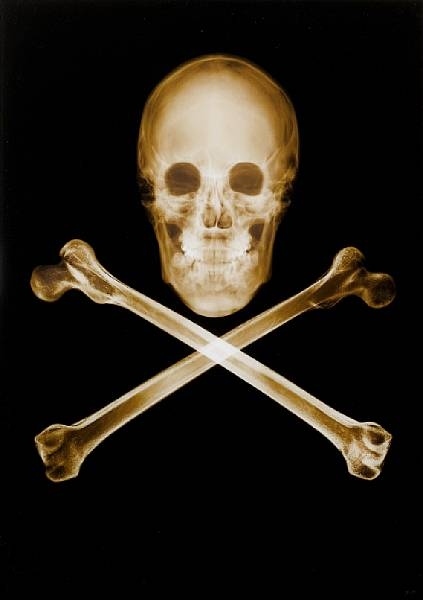 Artwork by Nick Veasey, 'Skull and Crossbones', Made of C-type print on diasec
