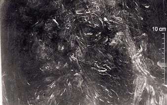 Hospital X-ray reveals £50,000 painting beneath nude