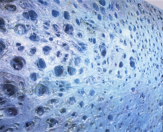 Gereon Krebber: Azurkomplex - Lehmbruck Museum