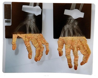 Matthew Cox’s Embroidered X-Rays and MRIs