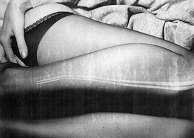 Intimate Self-Portraits Document One Artist’s Struggle With Disease