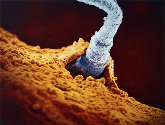 Spermie Penetrerar Aggcellen from a Child is Born by Lennart Nilsson, Published 1990