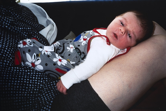 Fritz 5 days by Nan Goldin, 1998