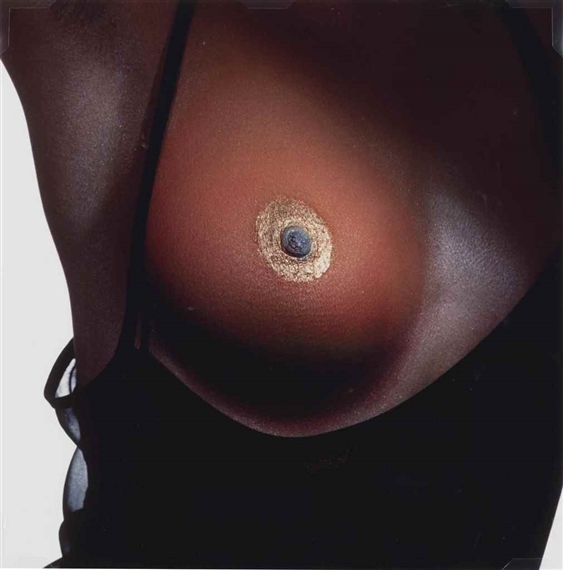 Breast (A), New York, March 5th, 1993