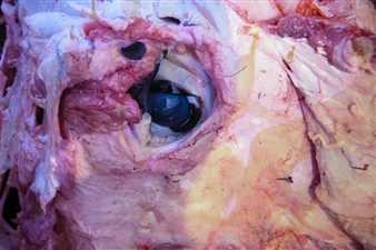 The Brother Moves On: Hlabelela: It’s a New Mourning Nkush  - Goodman Gallery, Johannesburg