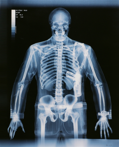 Gunman by Nick Veasey, 2003