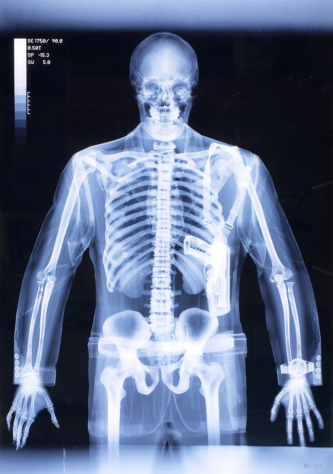 Artwork by Nick Veasey, Gunman, Made of C-print diasec