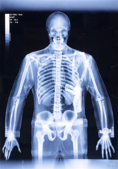 Gunman by Nick Veasey, 2003