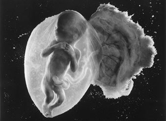 Foetus 18 Weeks: The Greatest Photograph of the 20th Century?