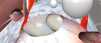 Philipp  Pess - Bildraum 01