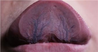 Do We Really Need an Exhibition of Women’s Art? Yes