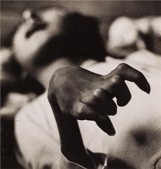 W. Eugene Smith | Iwazo Funaba's crippled hand, Minamata, Japan (1972) |  MutualArt