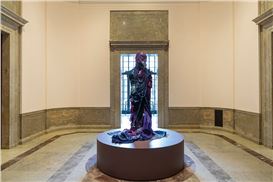 In Defence of Progressive Deaccessioning