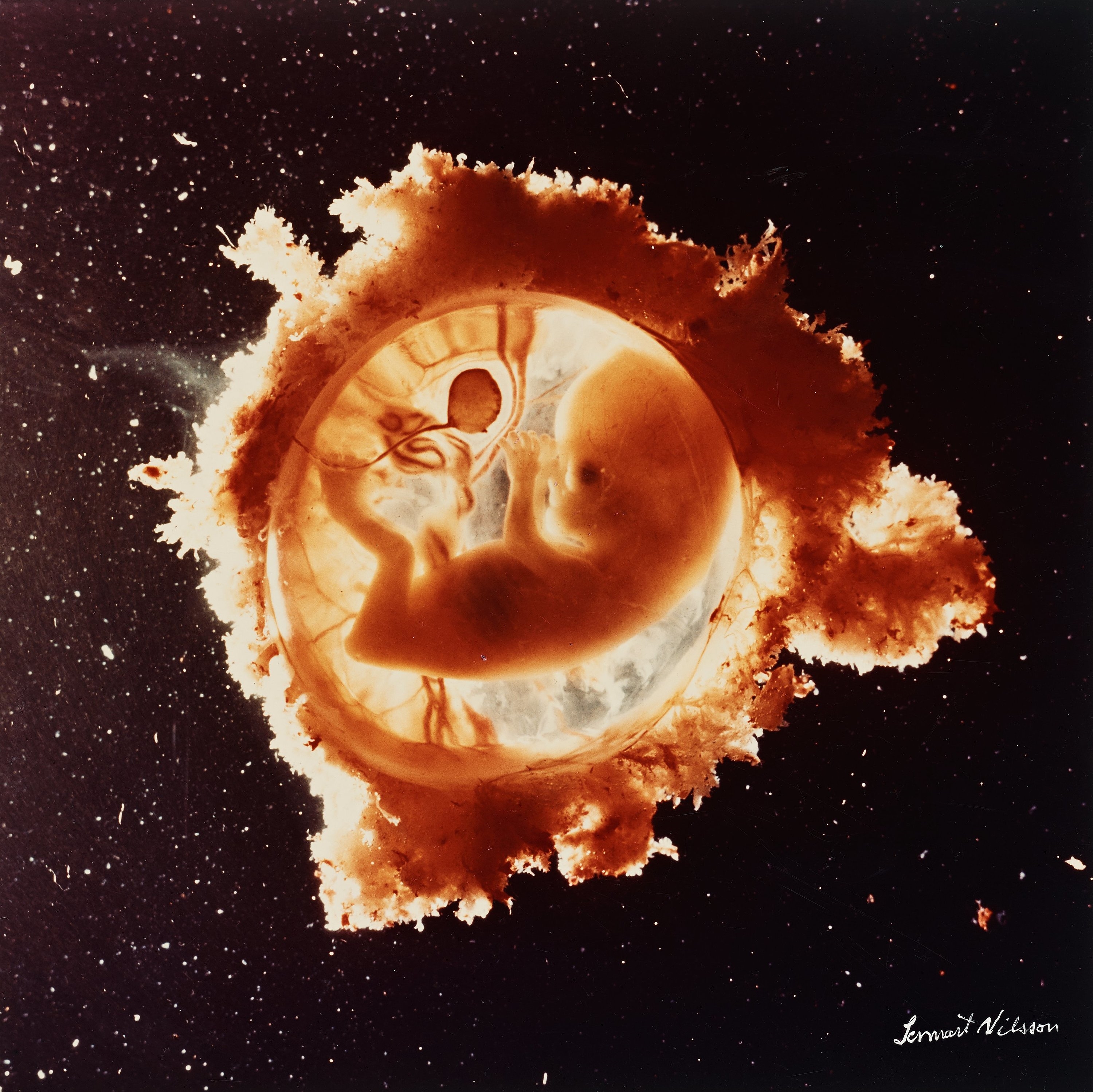 Artwork by Lennart Nilsson, "Rymdfararen", Made of Cibachrome