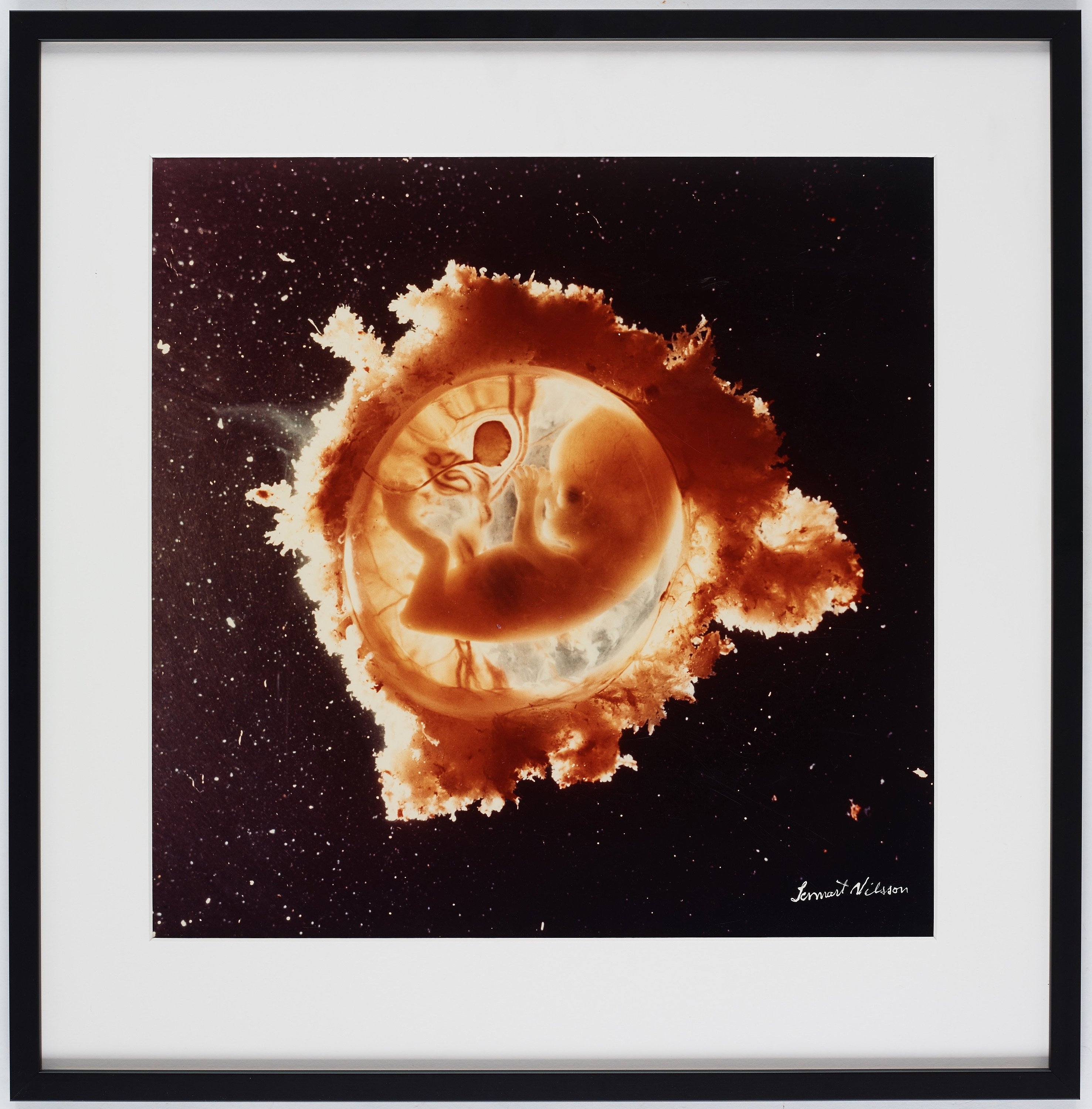 Artwork by Lennart Nilsson, "Rymdfararen", Made of Cibachrome