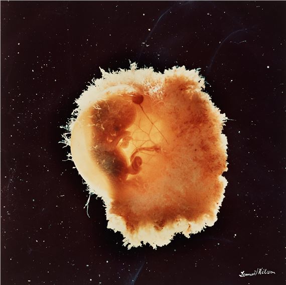 From "Ett barn blir till"