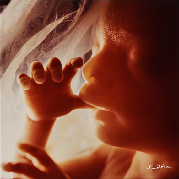 "Tumsugaren" by Lennart Nilsson, 1974