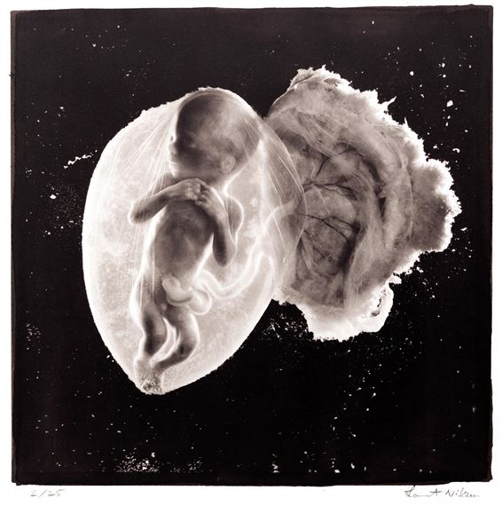 Foetus 18 weeks by Lennart Nilsson, 1965 printed 2015