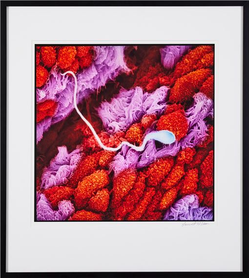 Ett barn blir till by Lennart Nilsson, 2013