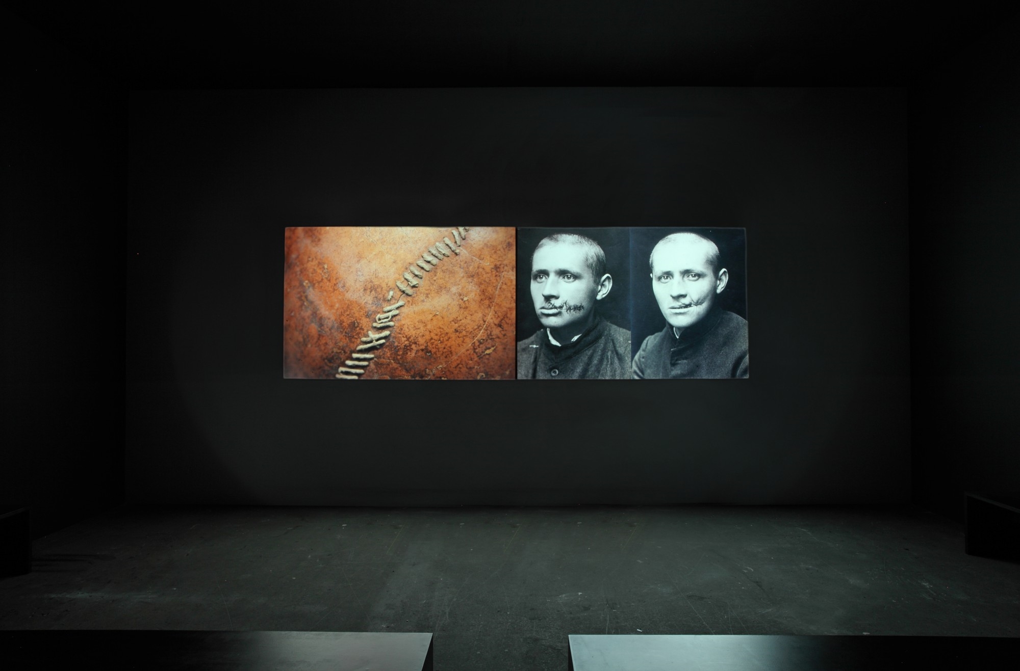 Artwork by Kader Attia, The Repair, Made of two channel slide projector, diptych of 80 slides