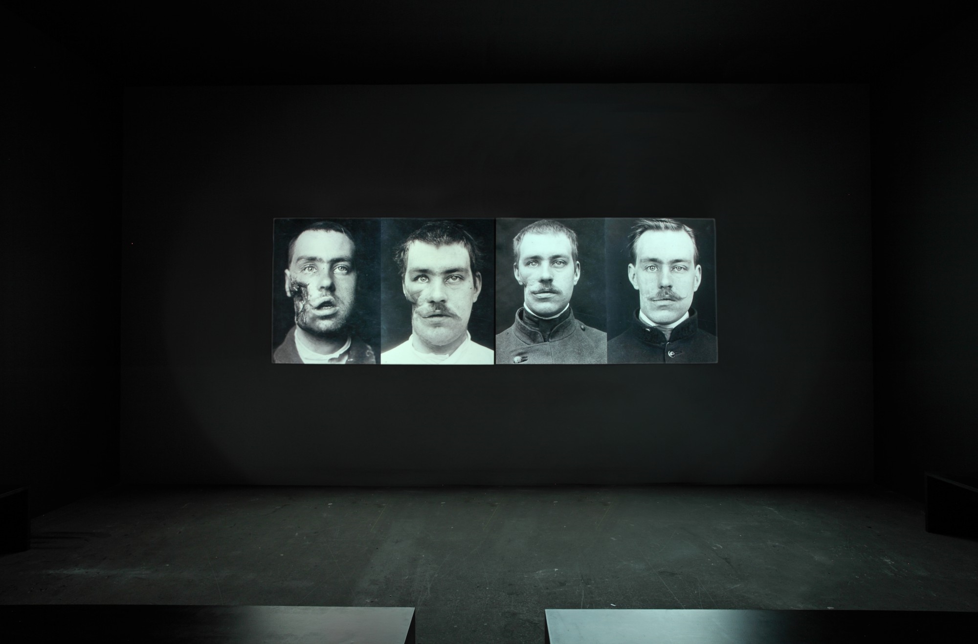 Artwork by Kader Attia, The Repair, Made of two channel slide projector, diptych of 80 slides