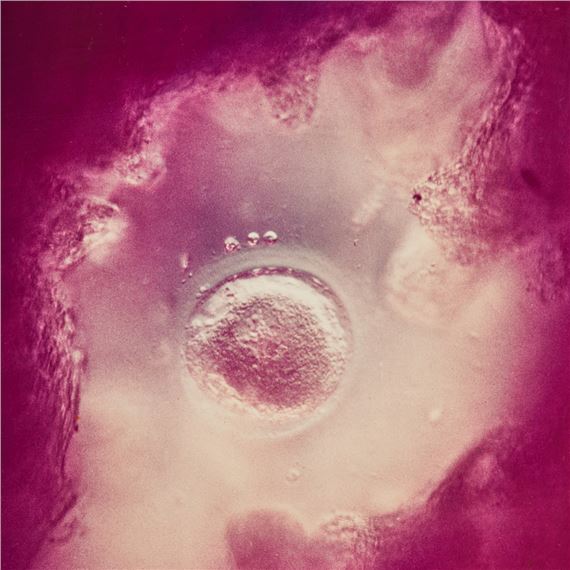 Untitled (cell) by Lennart Nilsson