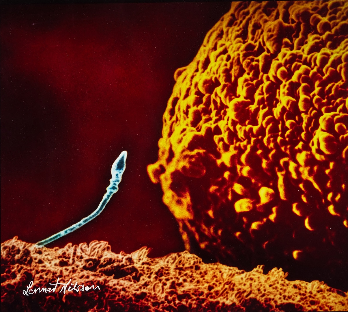 Artwork by Lennart Nilsson, First date, from "A child is born", Made of Cibachrome