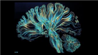 "Self Reflected" —a giant, dynamic 23k gold microetching depicting neural activity in the human brain - Dr. Greg Dunn