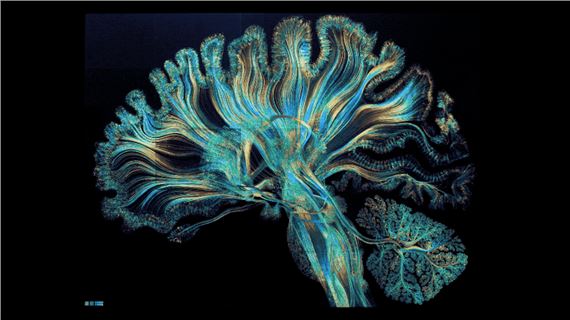 "Self Reflected" —a giant, dynamic 23k gold microetching depicting neural activity in the human brain - Dr. Greg Dunn
