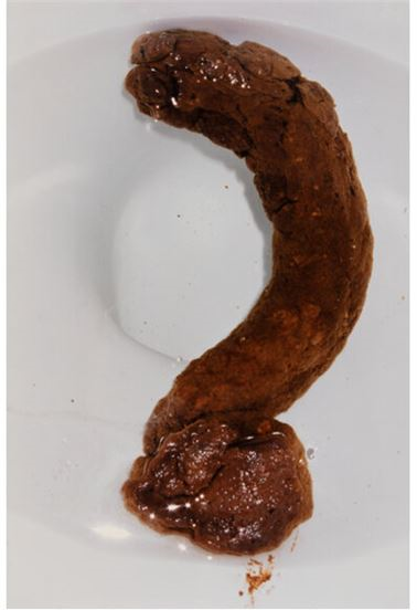 Terry Richardson | Number Two | MutualArt