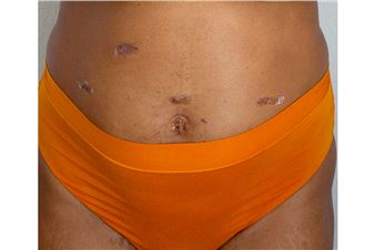 Presa House Gallery Debuts Two New Solo Exhibitions