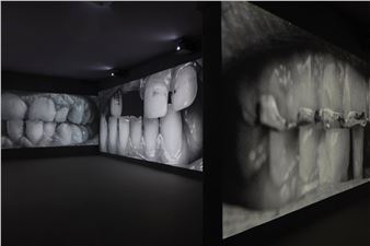 Santiago Sierra: 2.068 Dientes - Galería Helga de Alvear