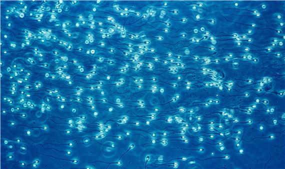 Lennart Nilsson, "Spermiehavet", 1965 by Lennart Nilsson, 1965