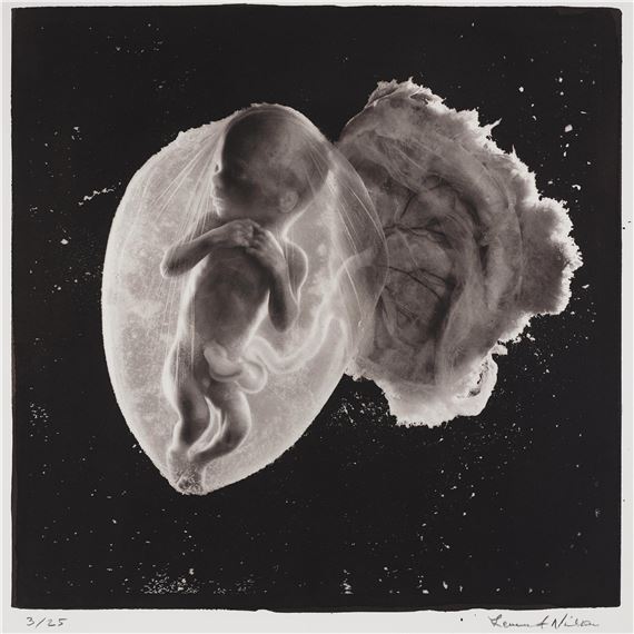 Lennart Nilsson, "Foster, 18 veckor", 1965 by Lennart Nilsson, Printed 2015