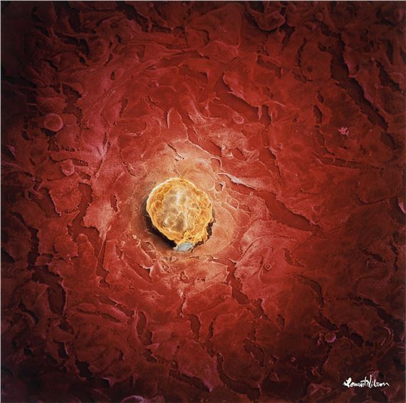 Impregnated human egg cell by Lennart Nilsson, 1990