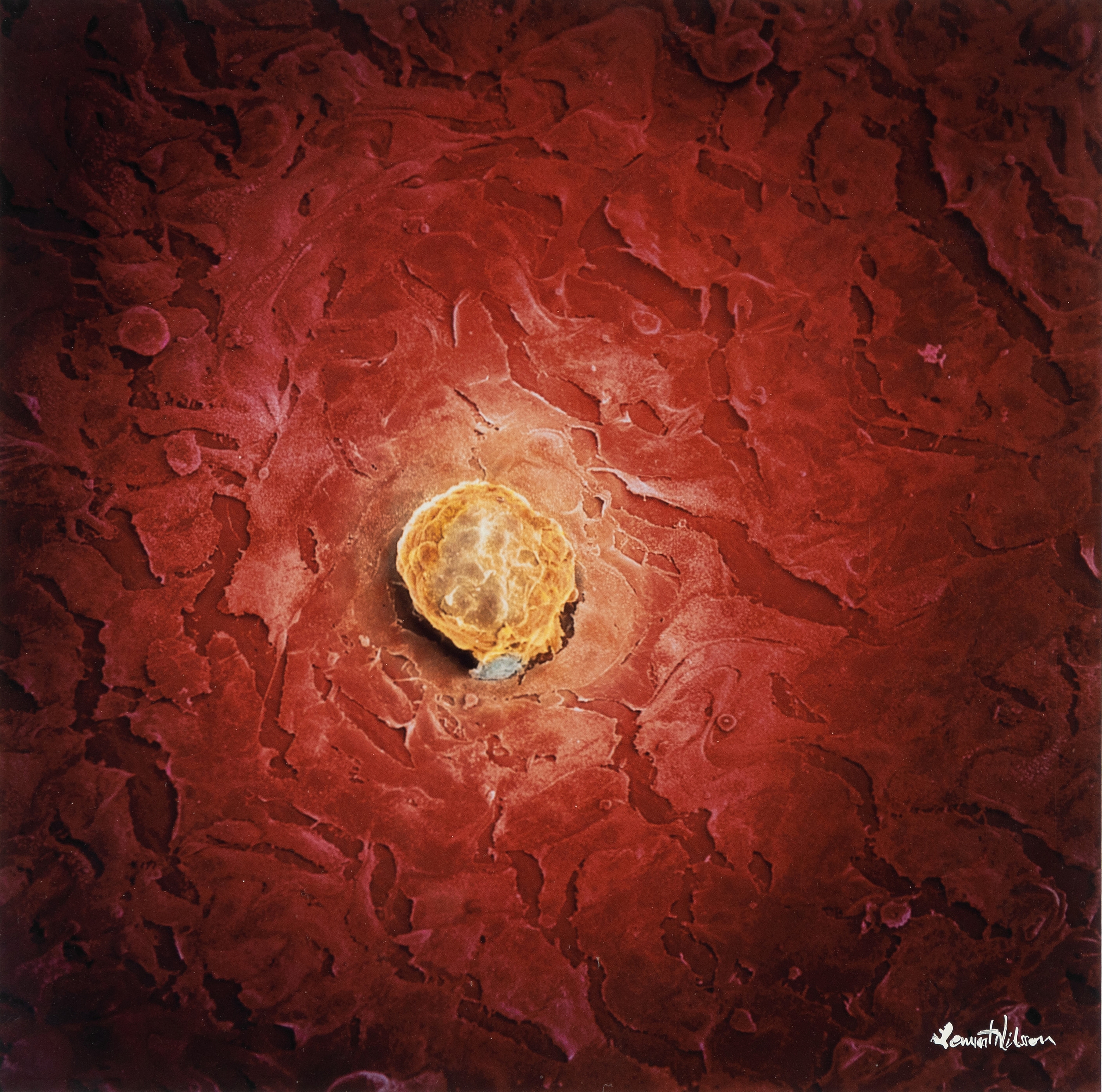 Impregnated human egg cell by Lennart Nilsson, 1990