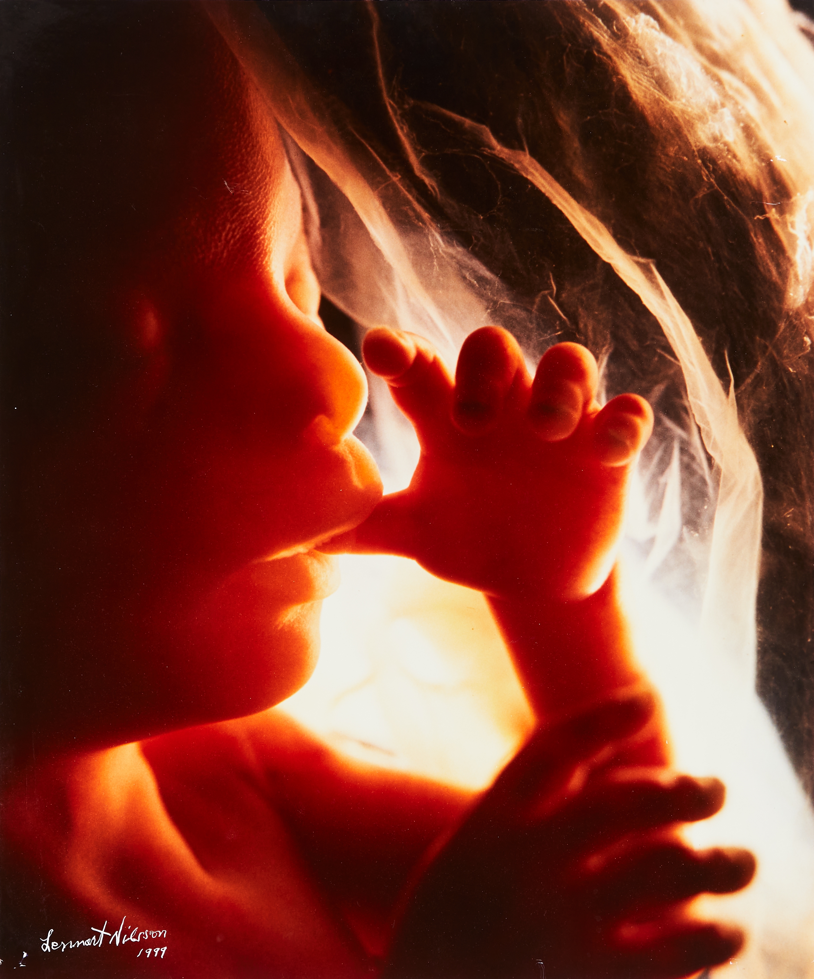 Artwork by Lennart Nilsson, Tumsugaren, Made of color photograph