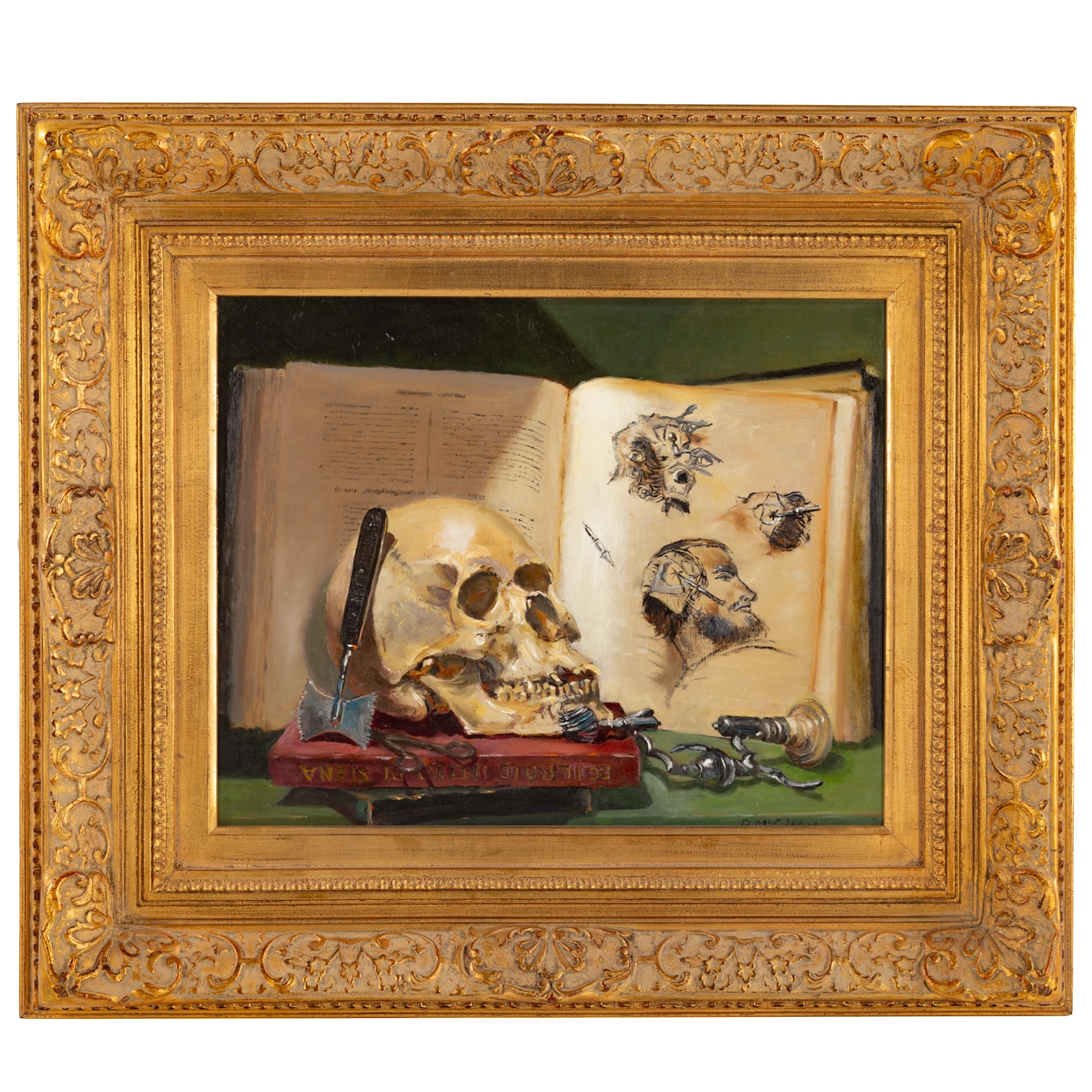 Bernard M. Mcgibbon | Trephination of Skull (1932) | MutualArt
