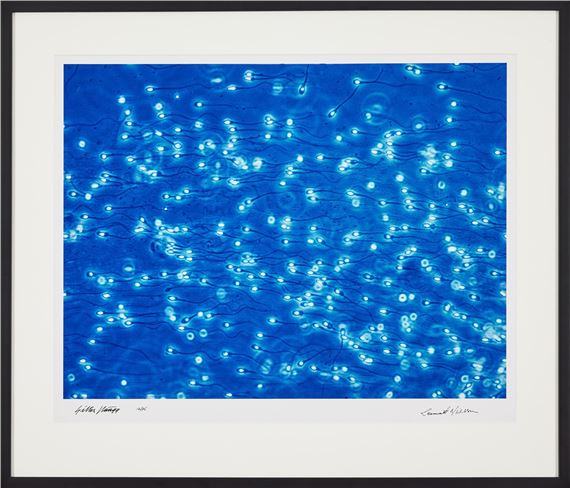 Spermier by Lennart Nilsson, Häägg Gillis