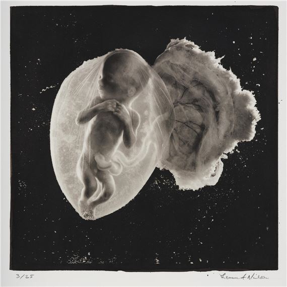 Foster, 18 veckor", 1965 by Lennart Nilsson, Printed 2015